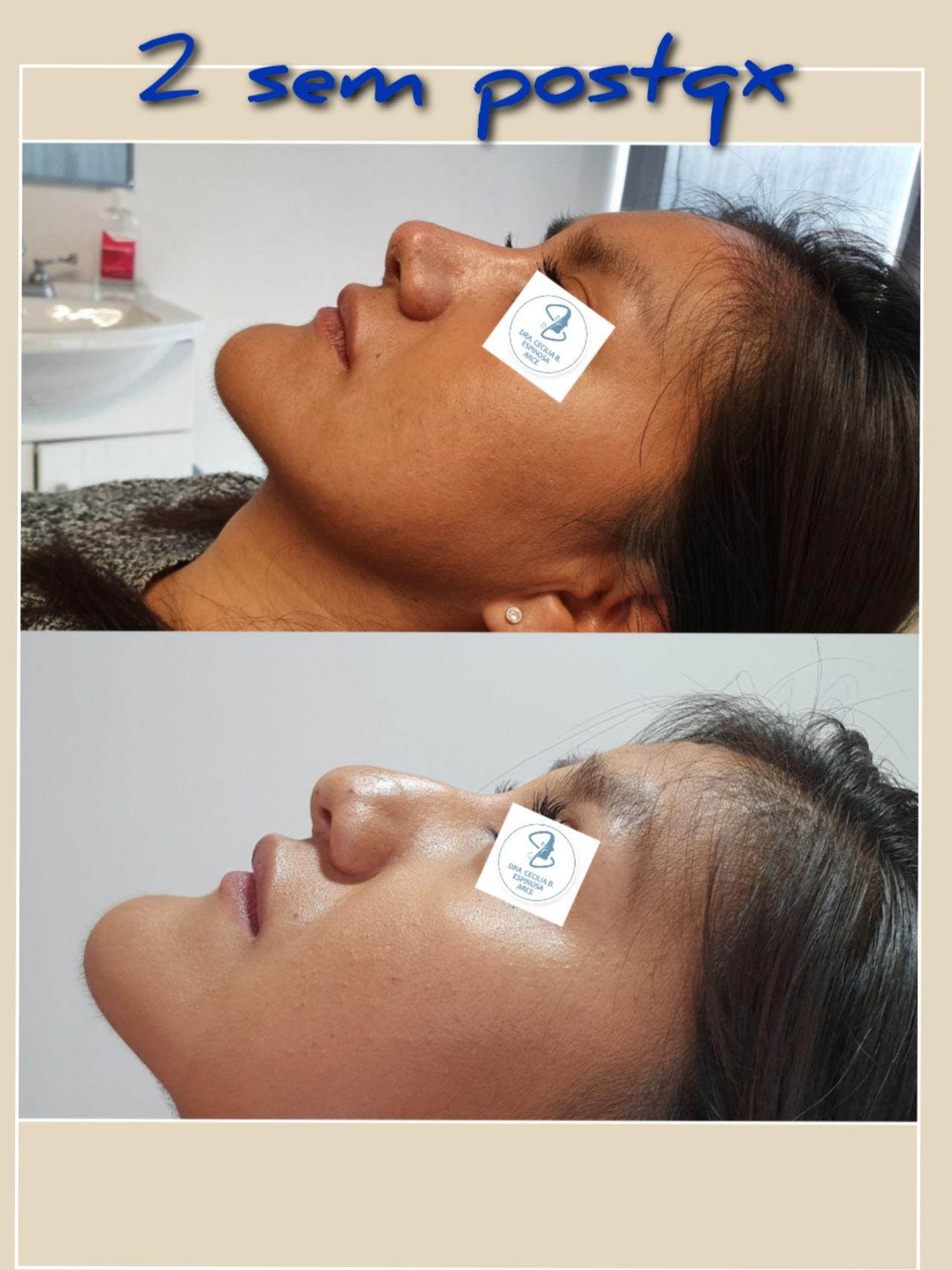 Cecilia Belen Espinosa Arce-32