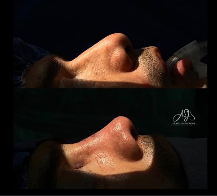 Axel Joffre Mora-267