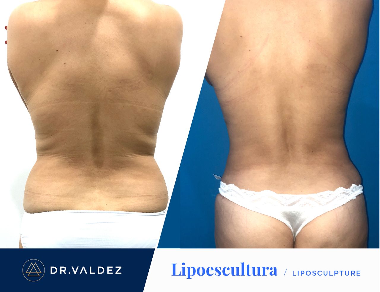 Pedro Arturo Valdez Gomez-16