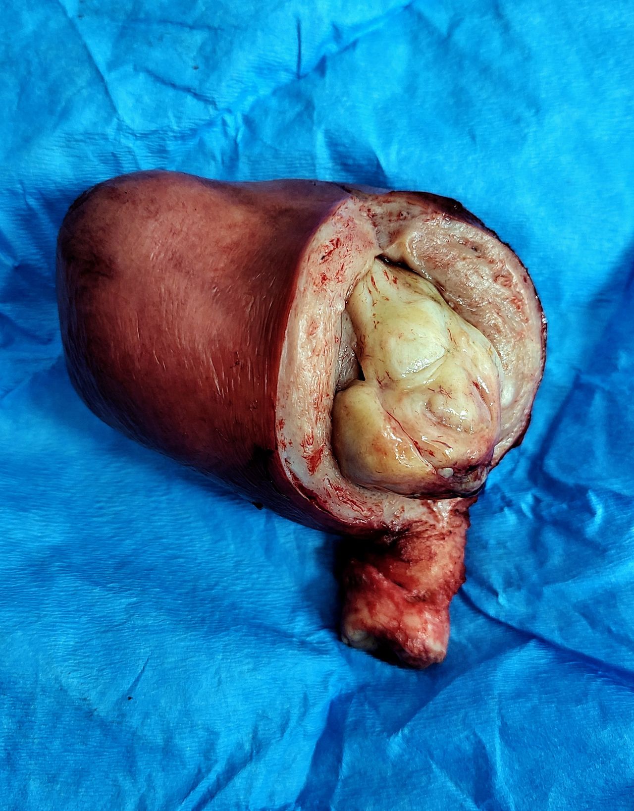 Luis Edmundo Hernández Vivar-5