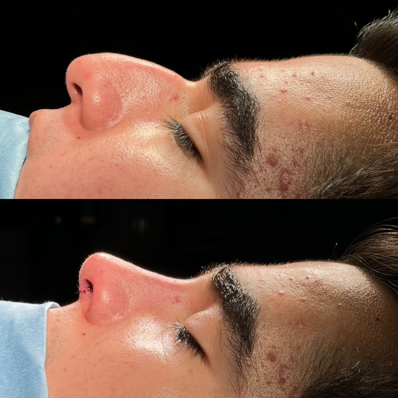 Angel Castro Urquizo-7