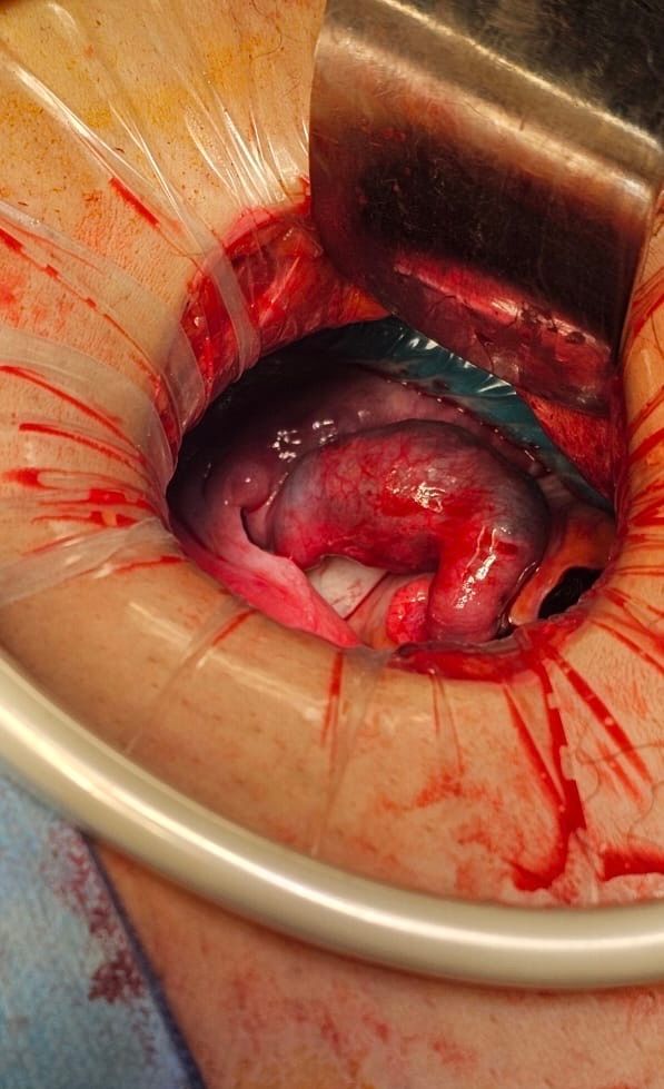 Patricia Elizabeth Torres González-2