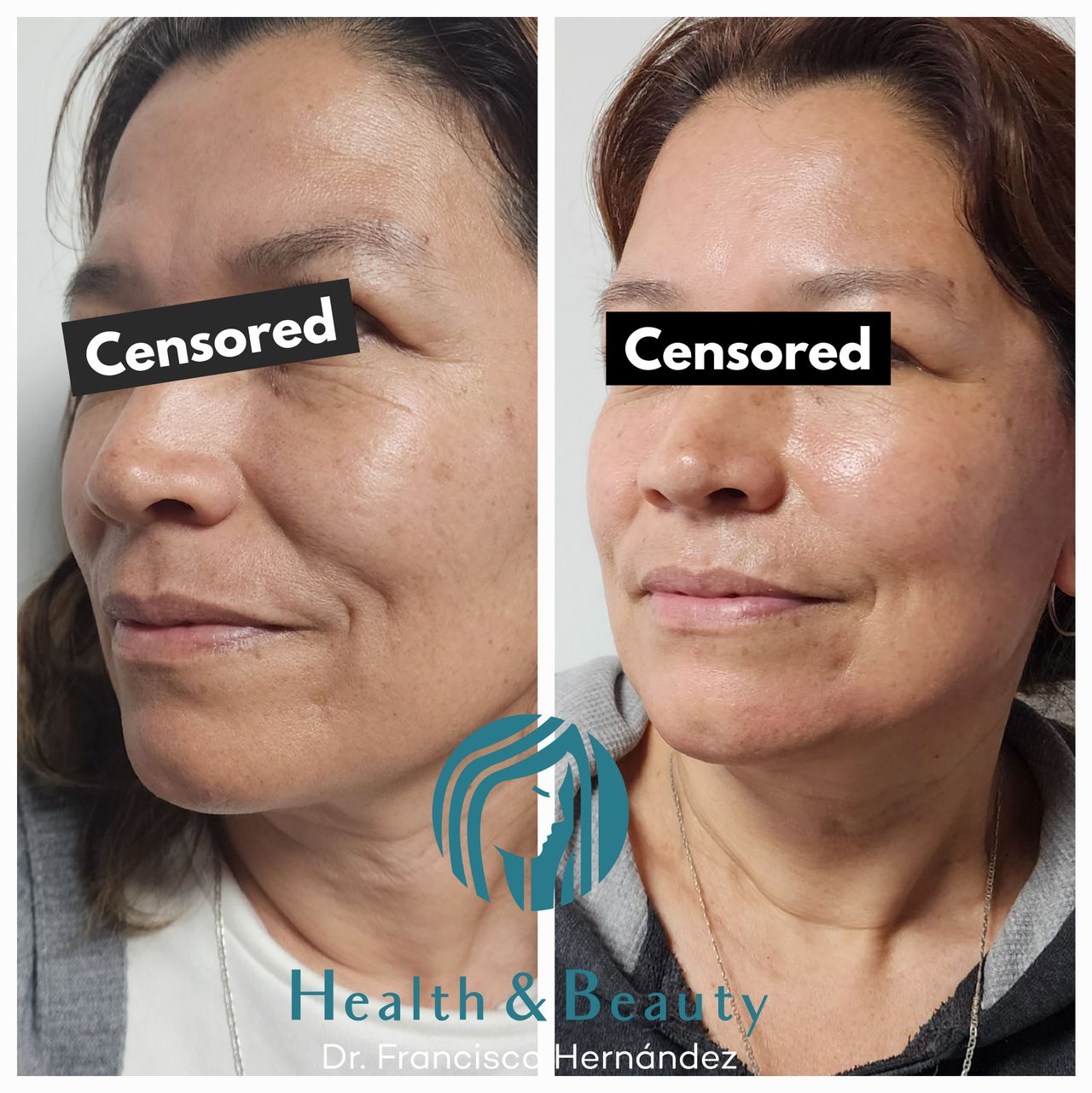 Francisco Hernández Gómez Crespo-38