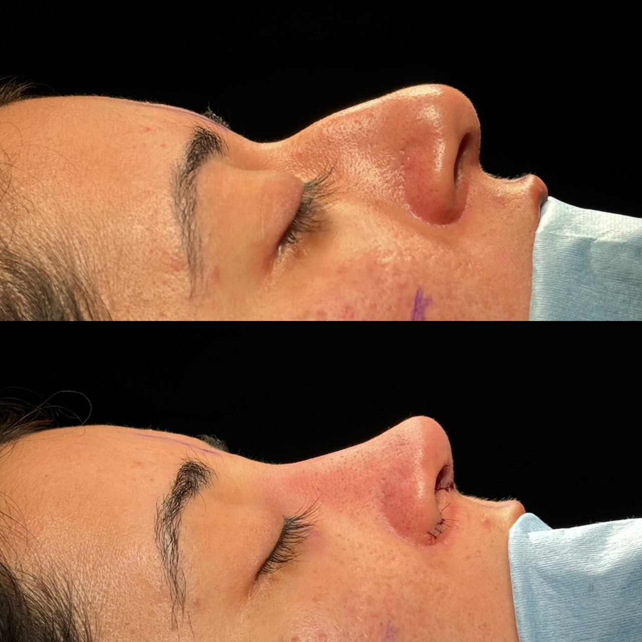 Angel Castro Urquizo-32