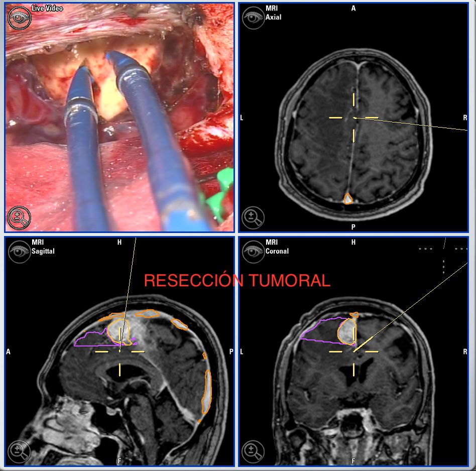 Enrique De Obieta Cruz-29