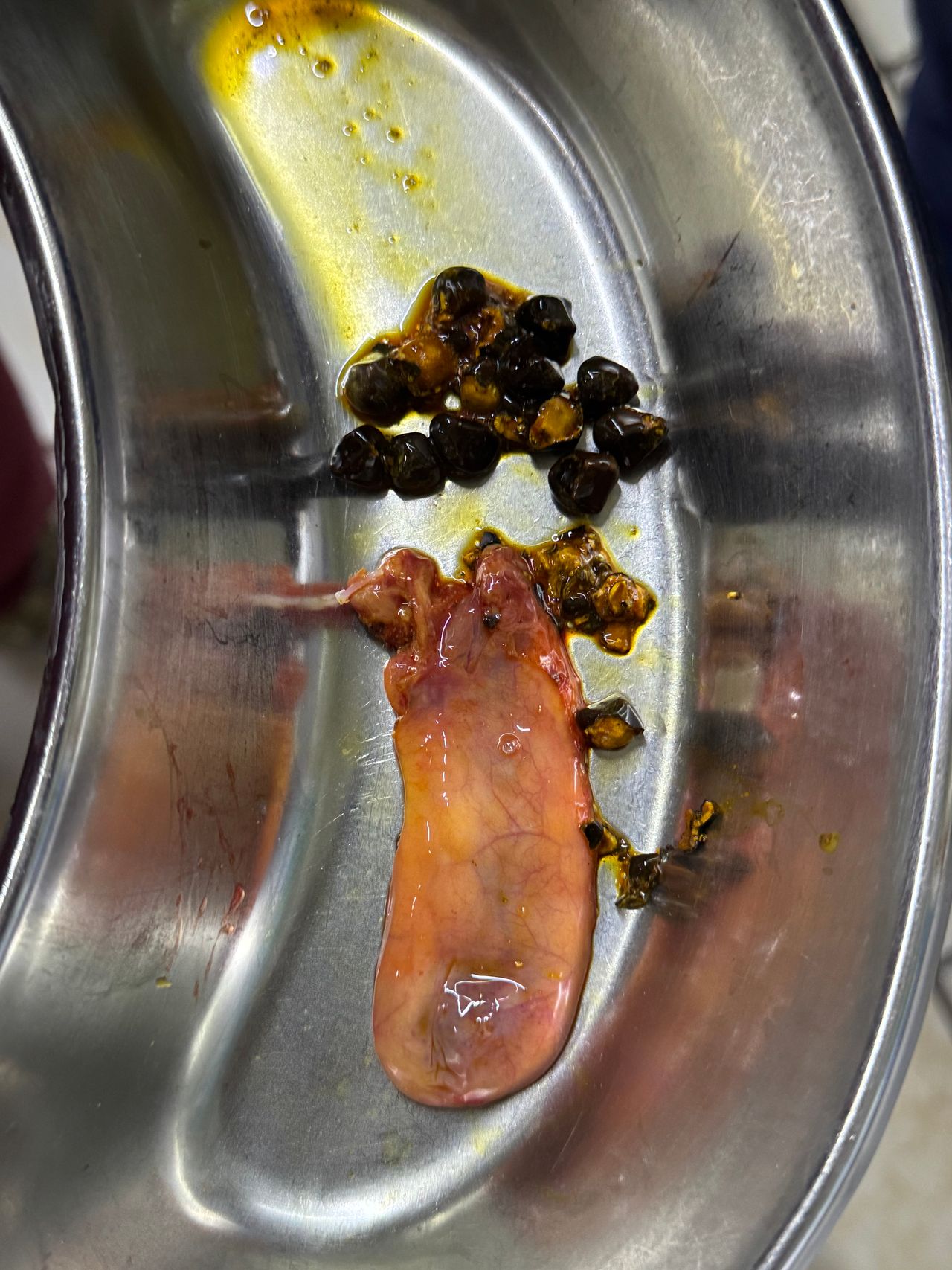 Gerardo Barrera Torres-5