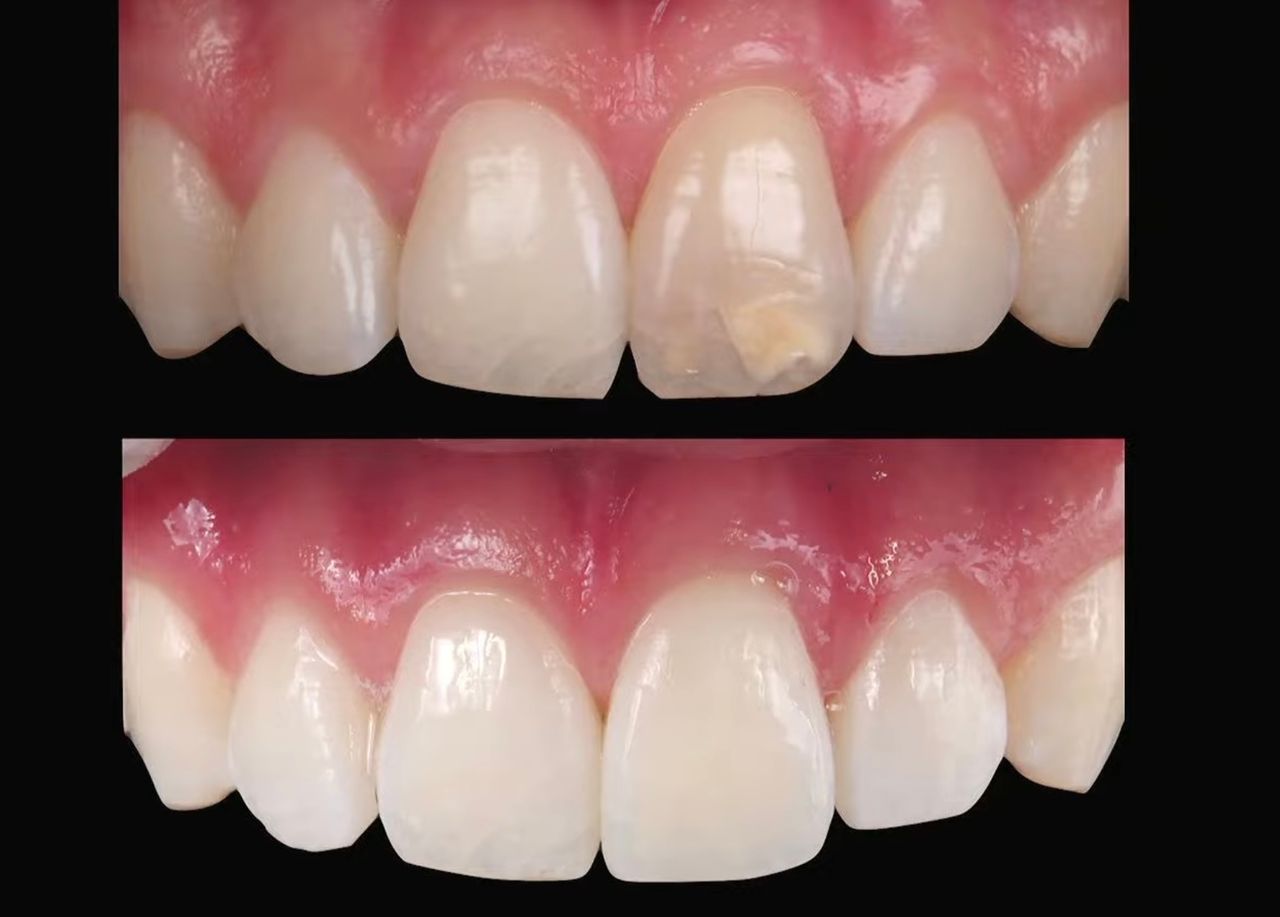 Ernesto Rojas Calderon-37