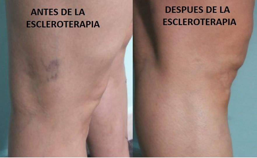 Marco Antonio Ayala García-9