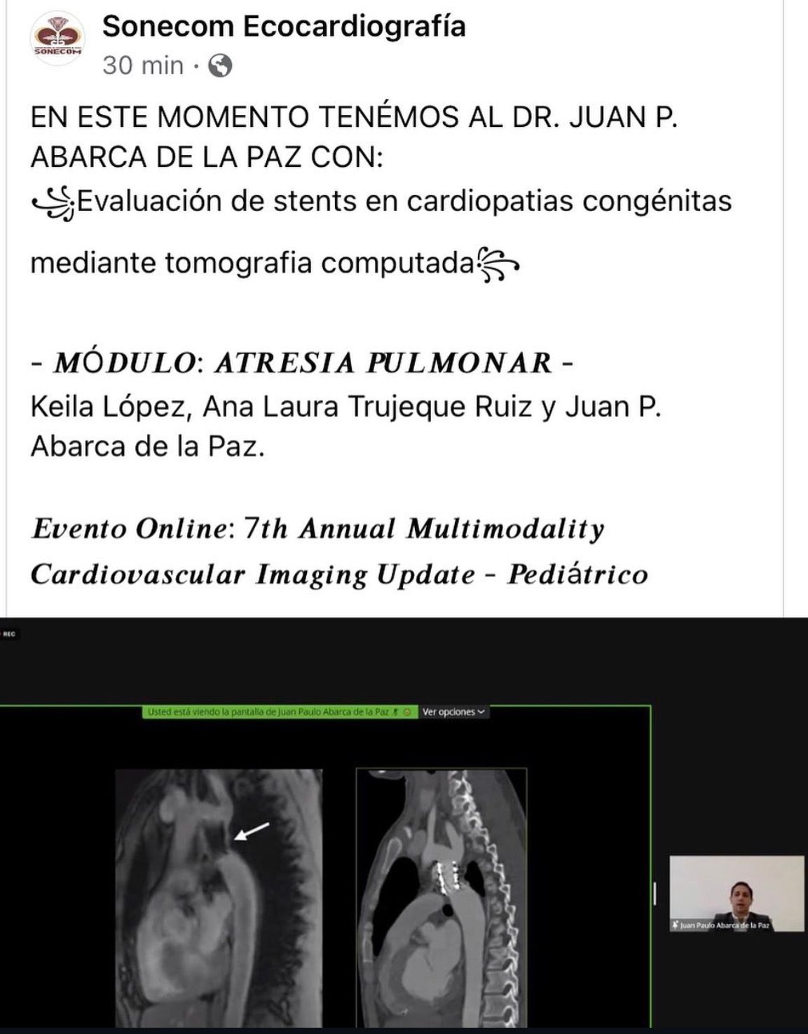 Juan Paulo Abarca De La Paz-8