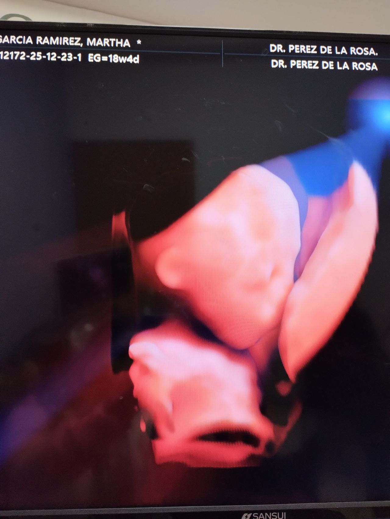 Abraham Ignacio Pérez De La Rosa-25