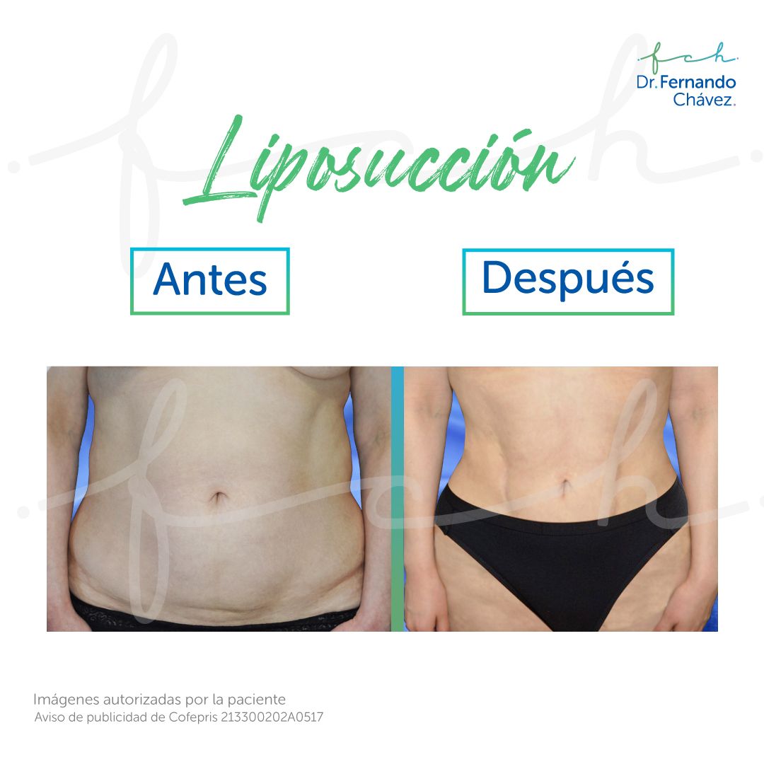 Fernando Chávez Osorio-16