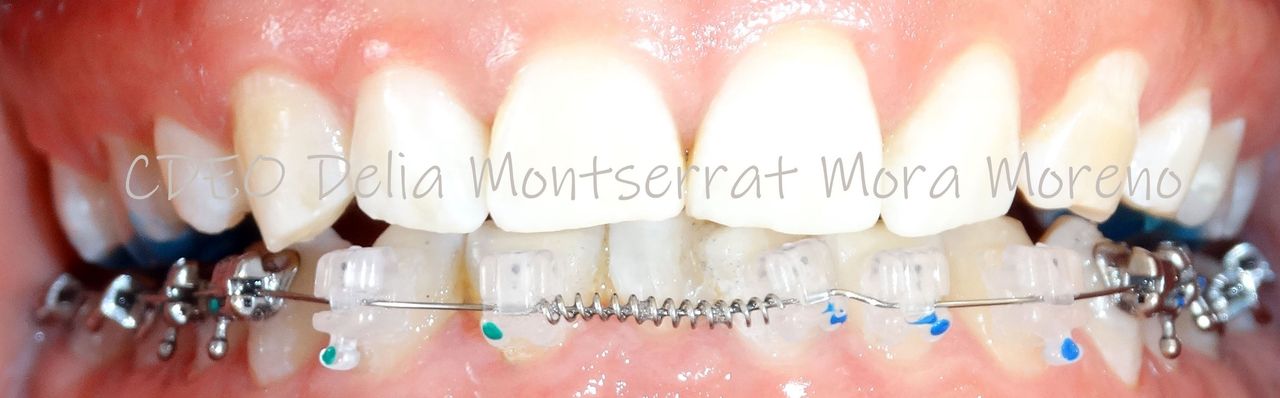 Delia Montserrat Mora Moreno-0