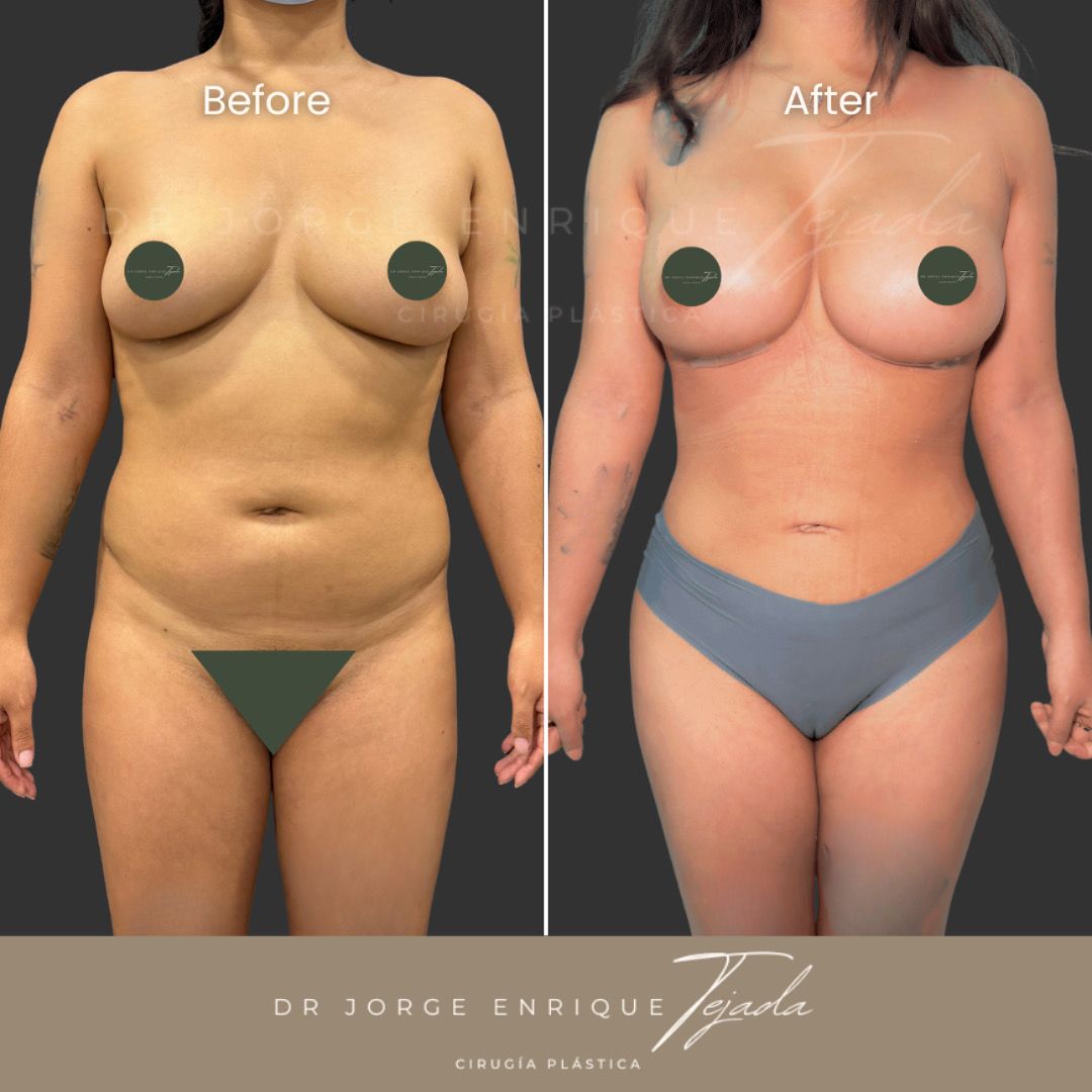 Jorge Enrique Tejada Aldazosa-5