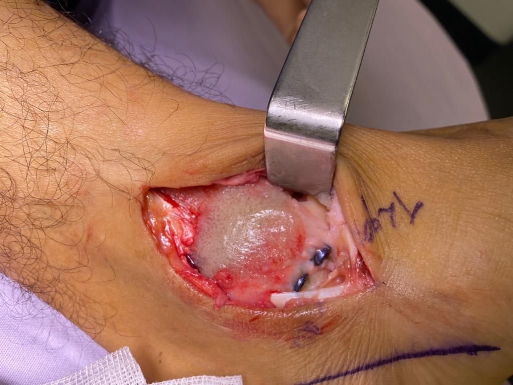 Alberto Lorenzo Cortés-20