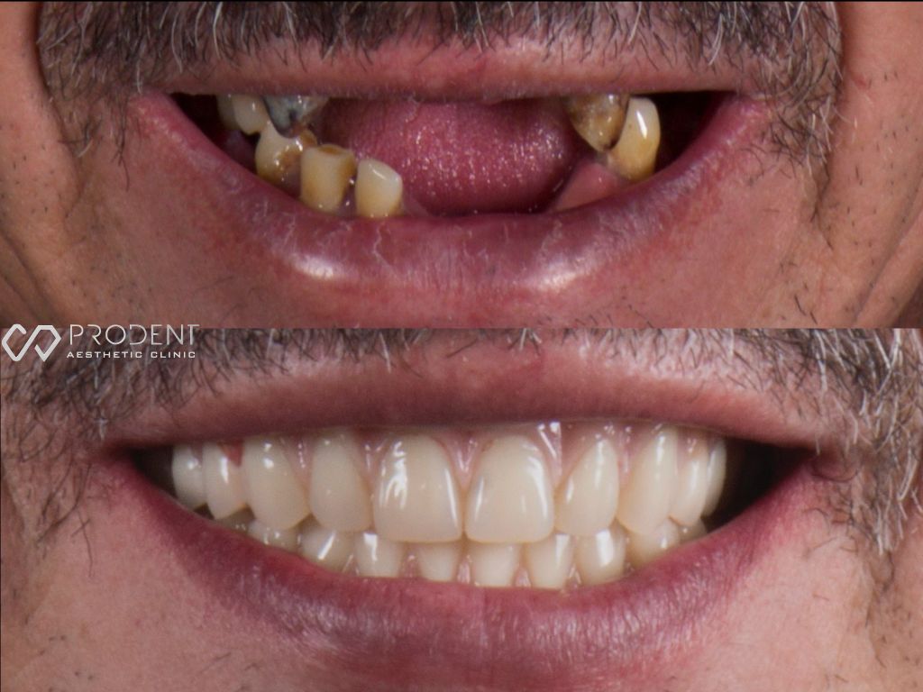 Ulises Pérez Murillo-39