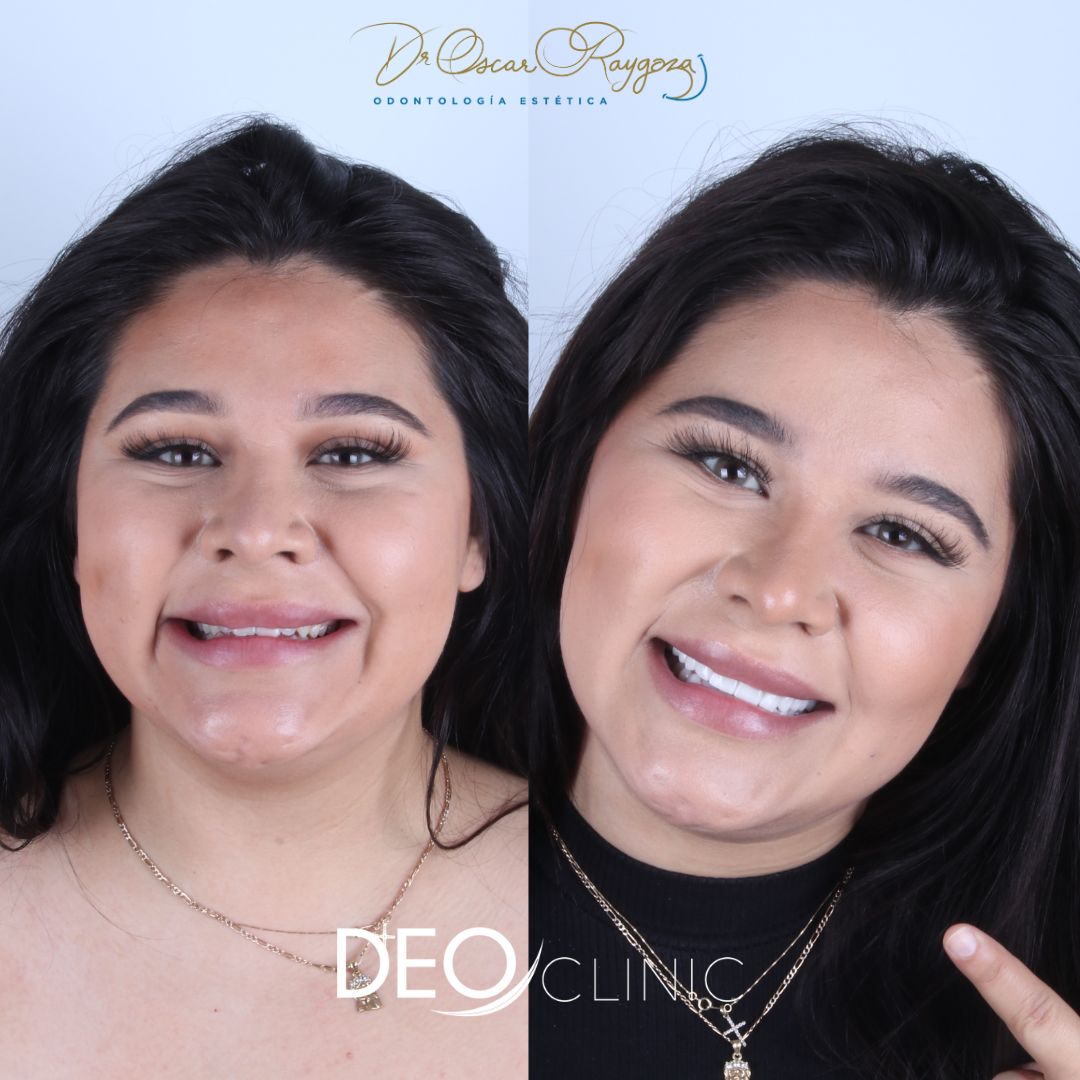 Oscar Raygoza Carrillo-21