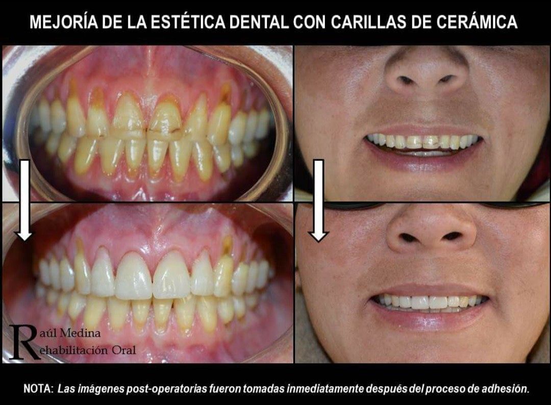 Raúl Uriel Medina Martinez-6