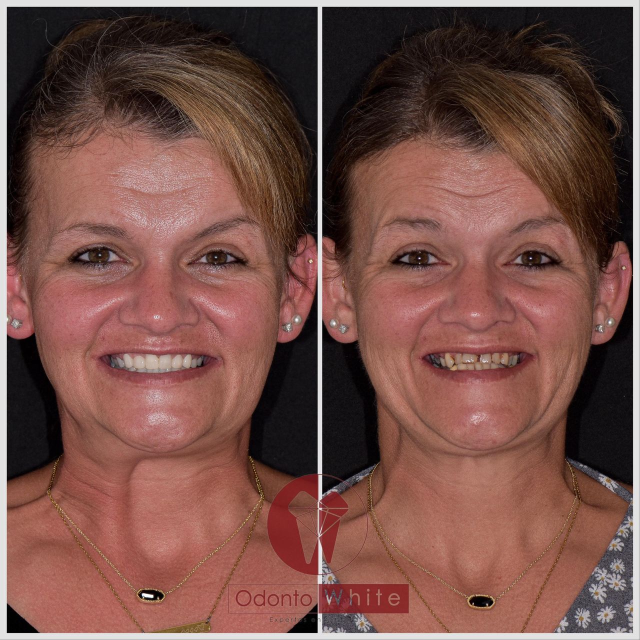 Gustavo López Torres-9