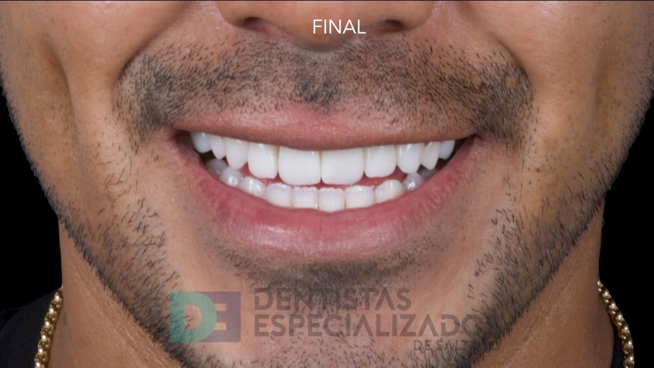 Omar Rodríguez Uvalle-0