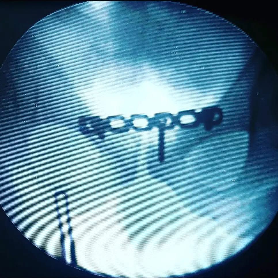 Iván Campos Hernández-13