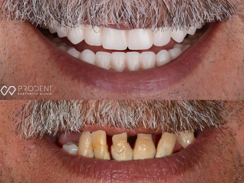 Ulises Pérez Murillo-97