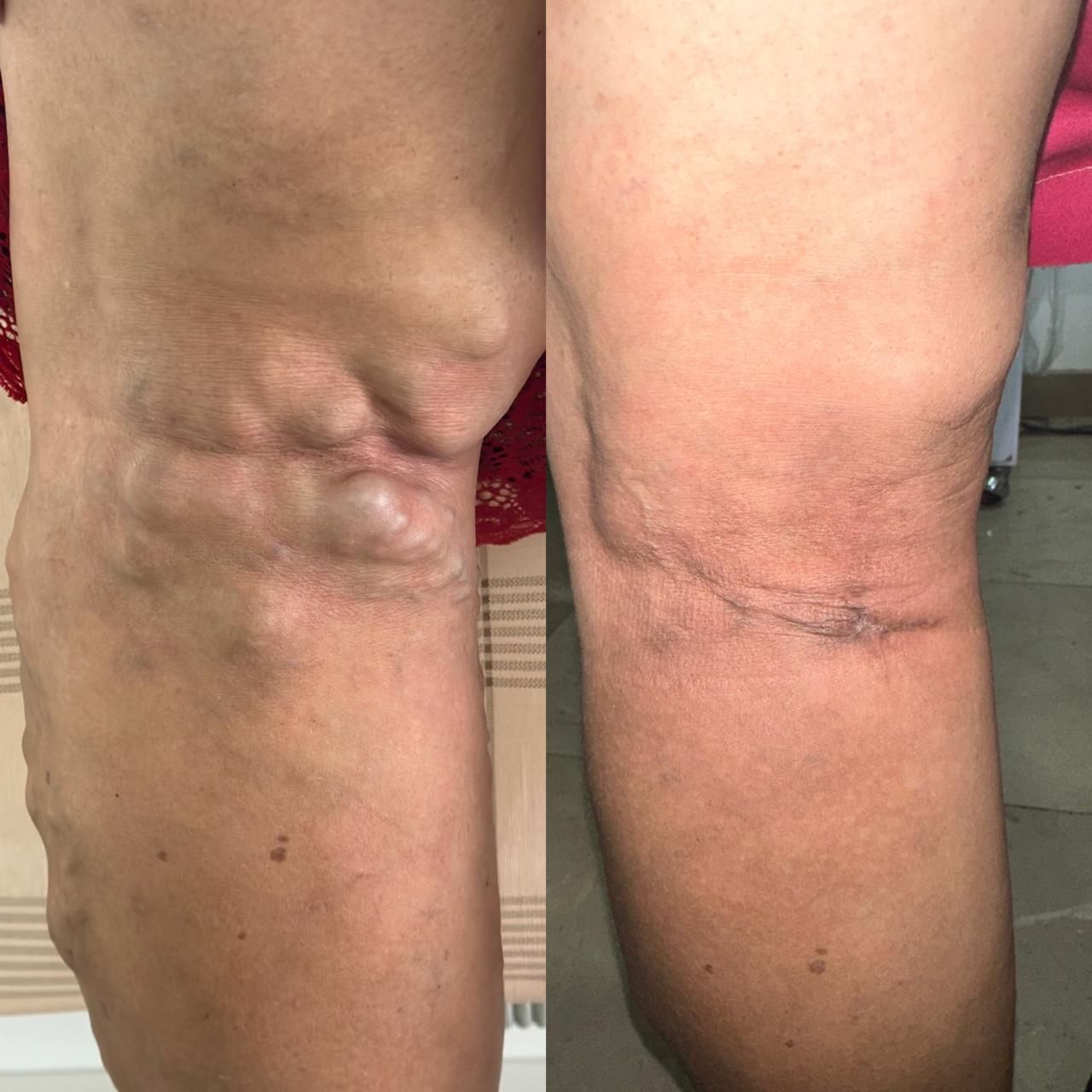 Jhonatan López González-54