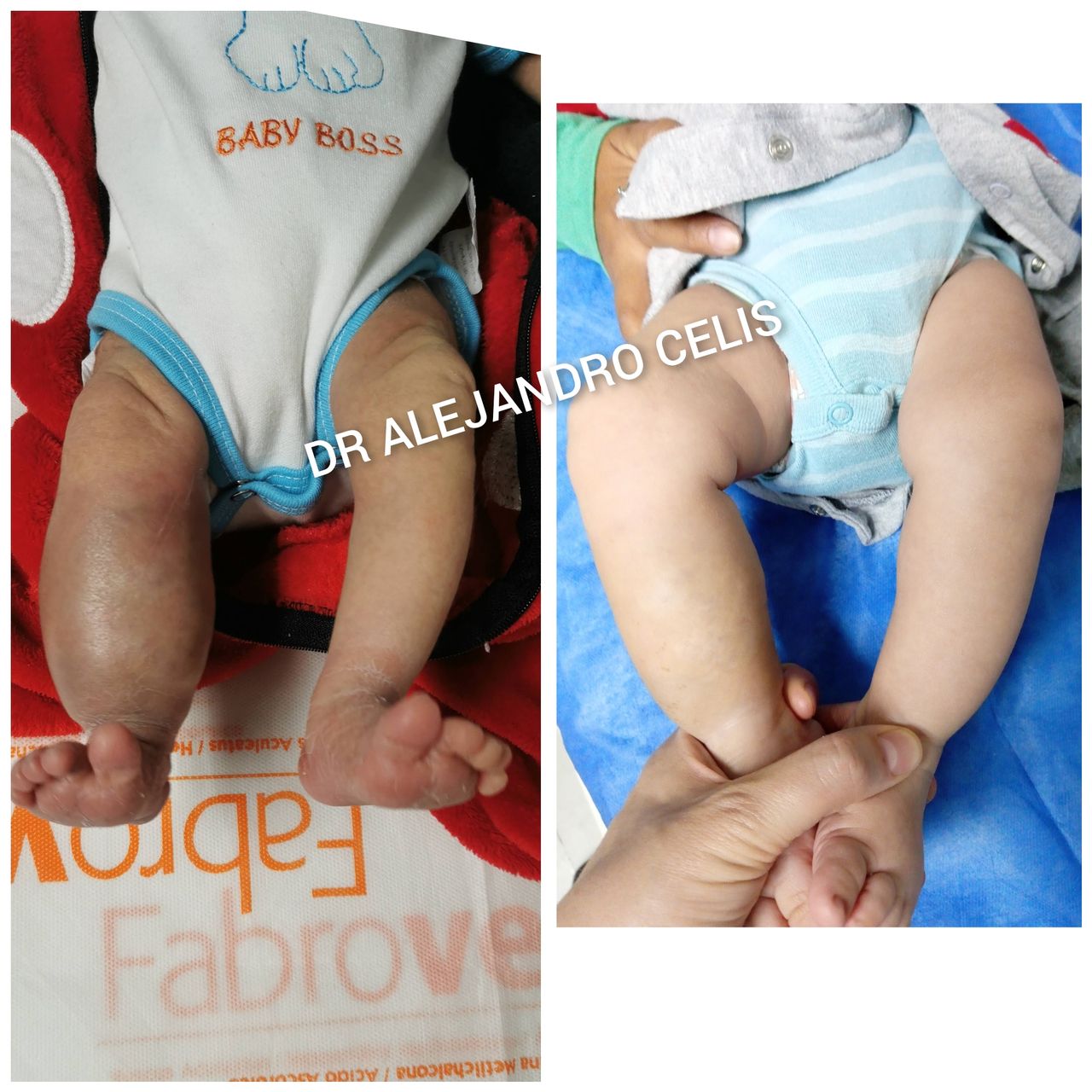 Alejandro Celis Jiménez-9