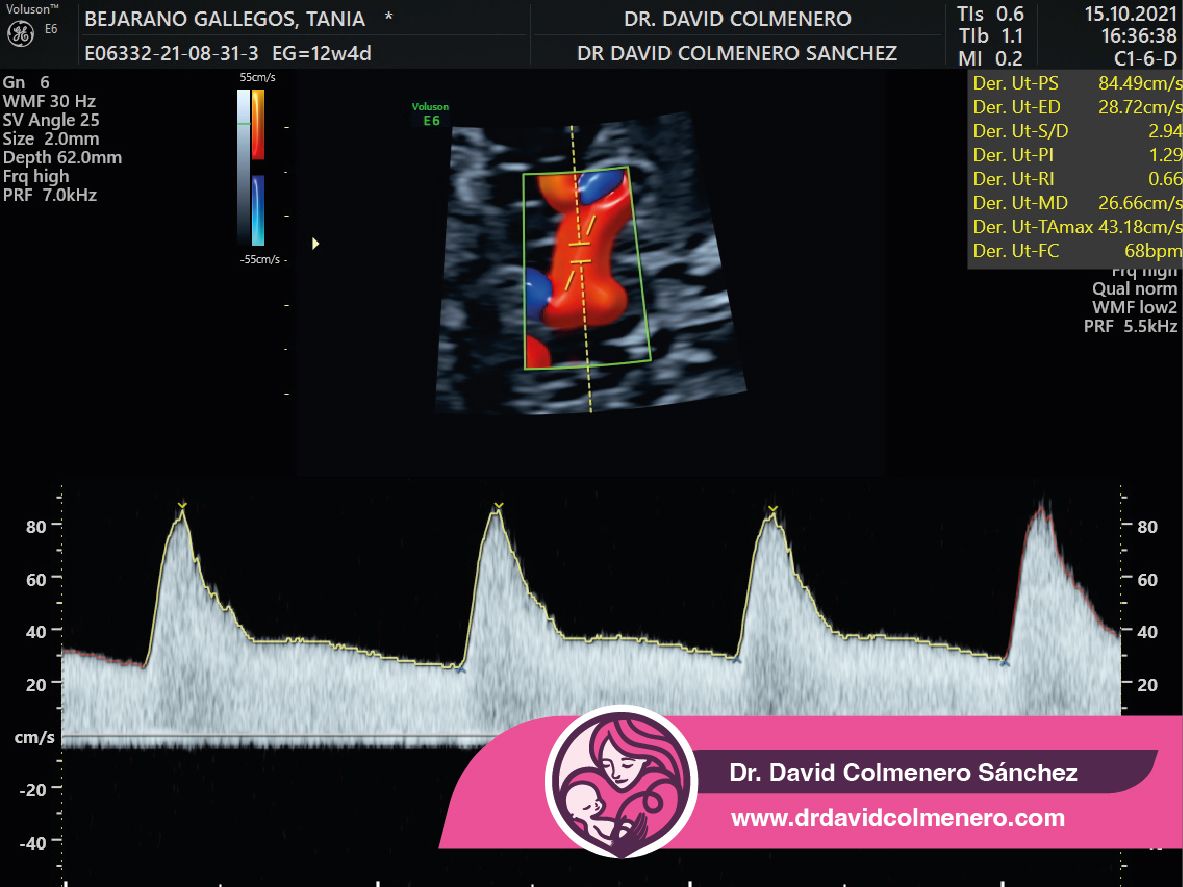 David Colmenero Sánchez-16