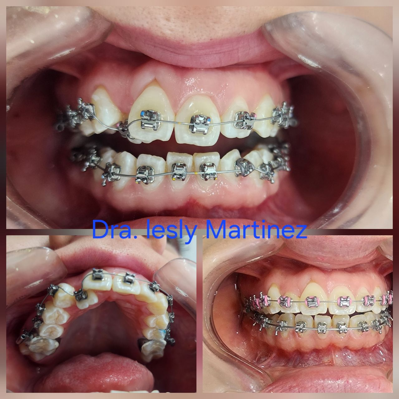 Lesly Martinez-12