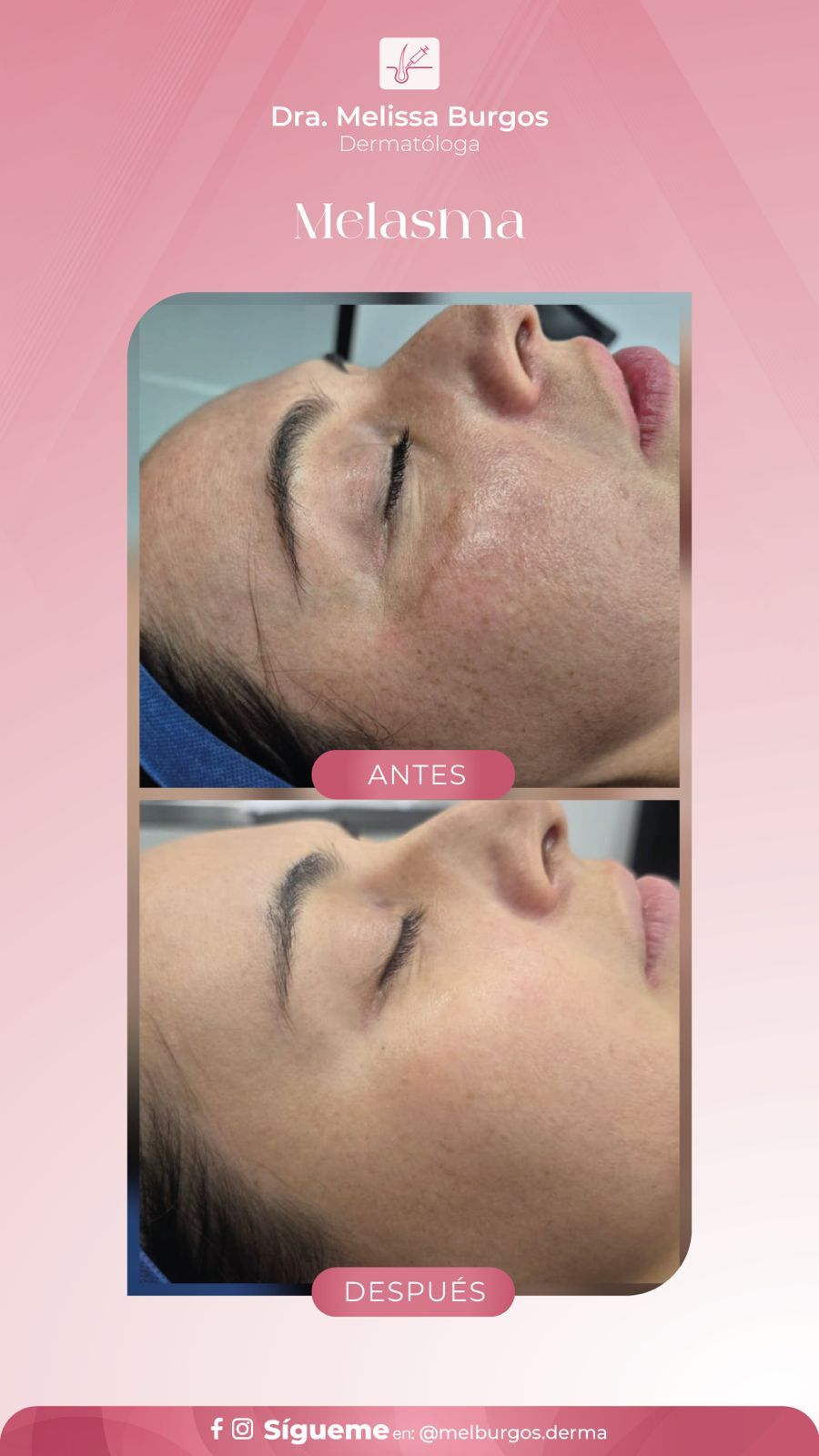 Melissa Burgos Romero-7