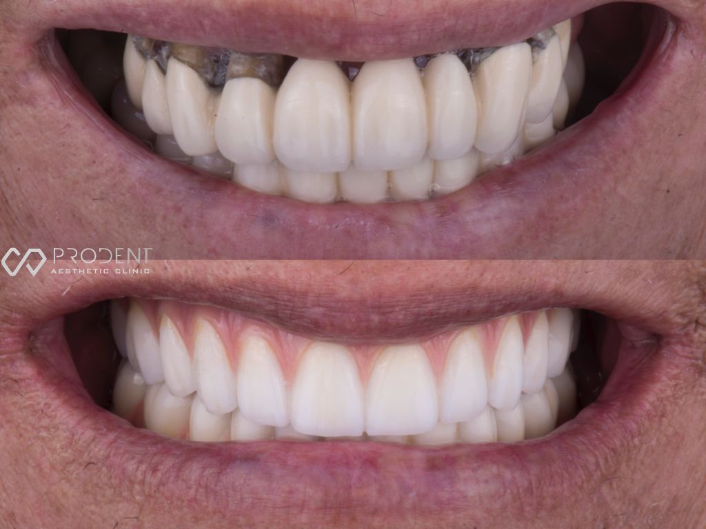 Ramiro Ivan Pérez Murillo-13