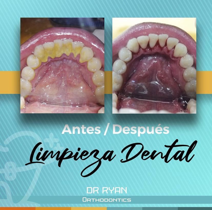 Ryan Michael Brenes Pacheco-6