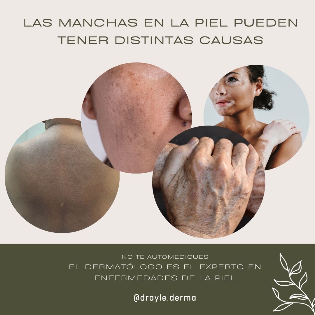 Eloiza Lizeth Ylé Arámburo-5