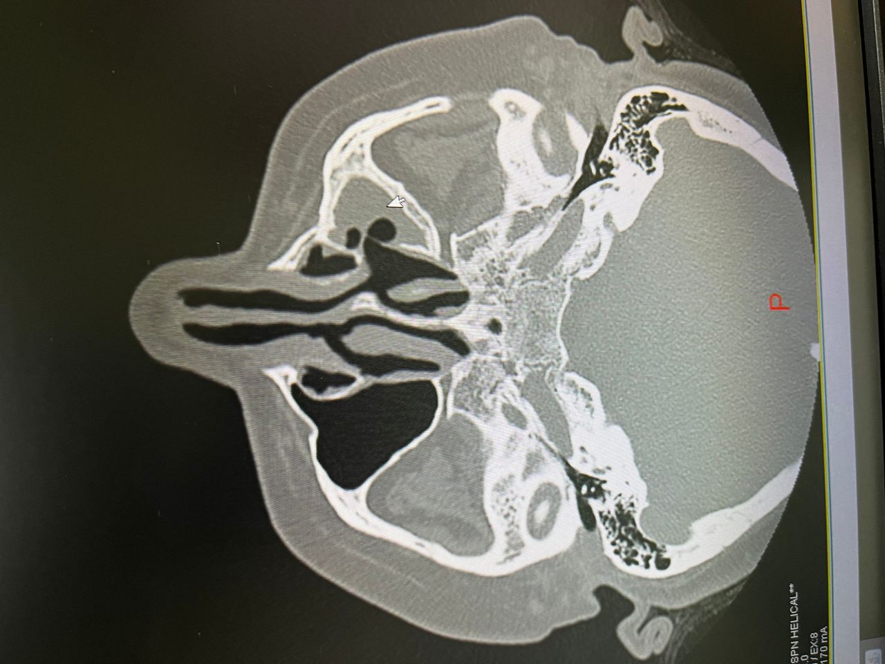 Irma Araceli Carrillo Soto-4