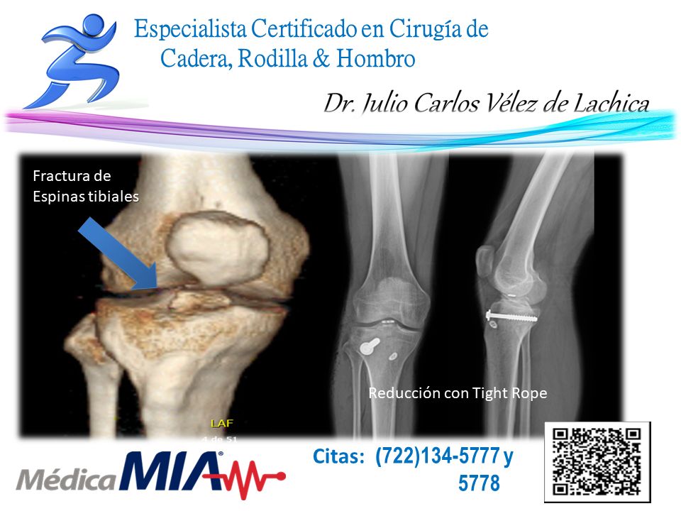 Julio Carlos Vélez De Lachica-39