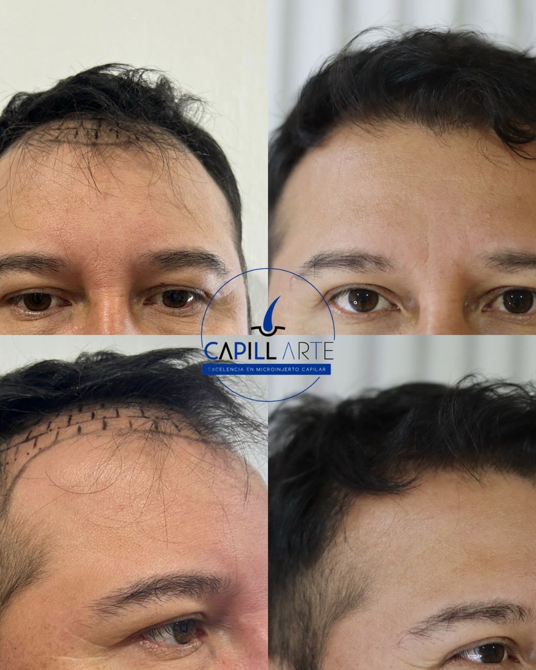 Adrian Hernandez Lopez-6