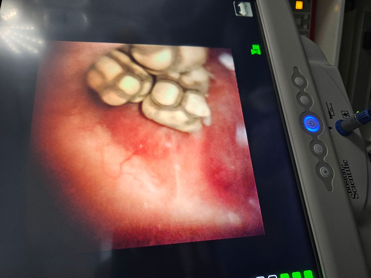 Michel Bastarrachea Solis-6