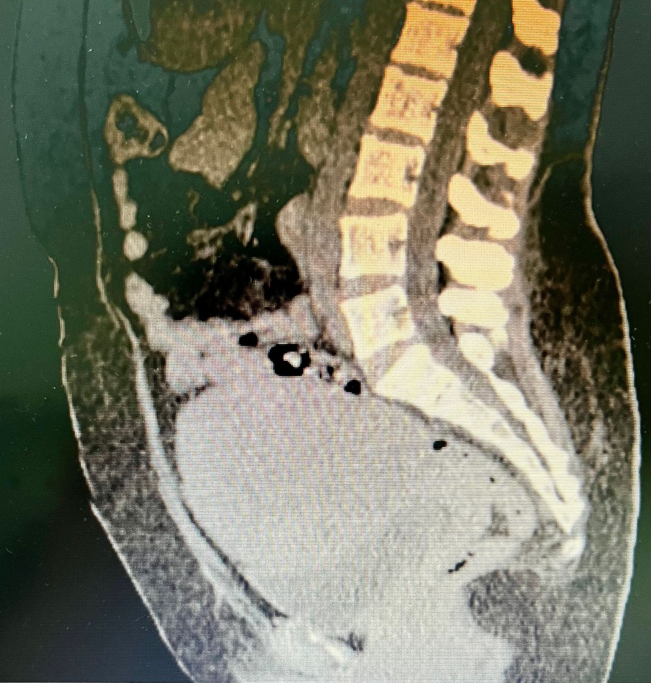 Rogelio Hernández García-55
