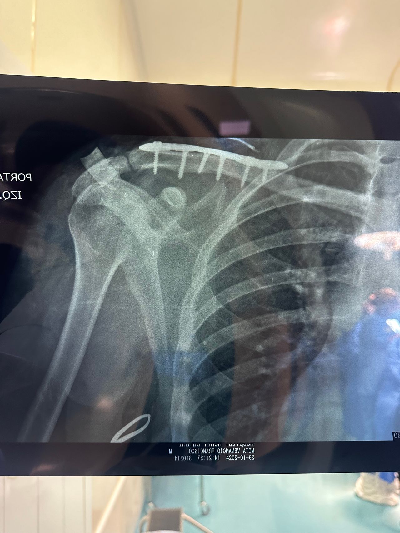 José Miguel Montiel Rojas-10