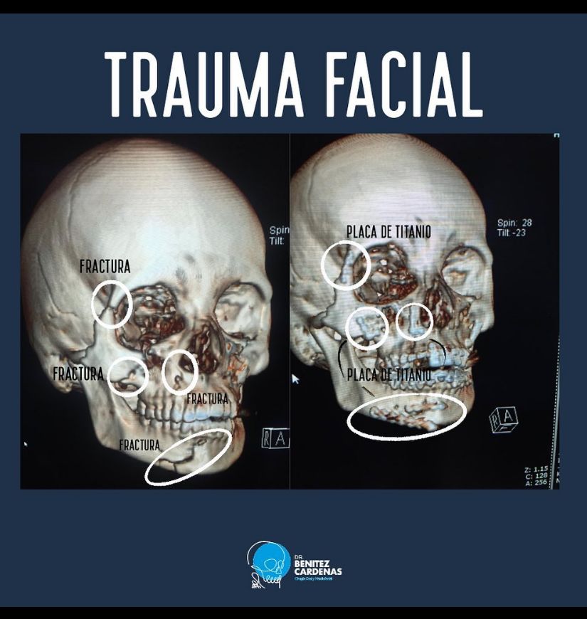 Oscar Arturo Benítez Cárdenas-10