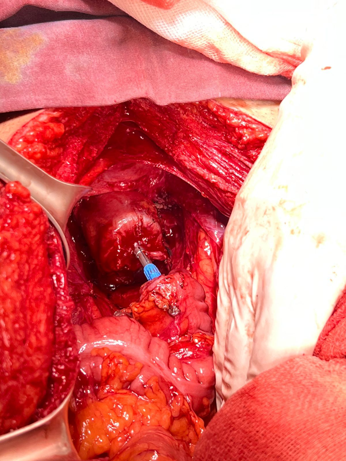 Armando Diaz Botello-3