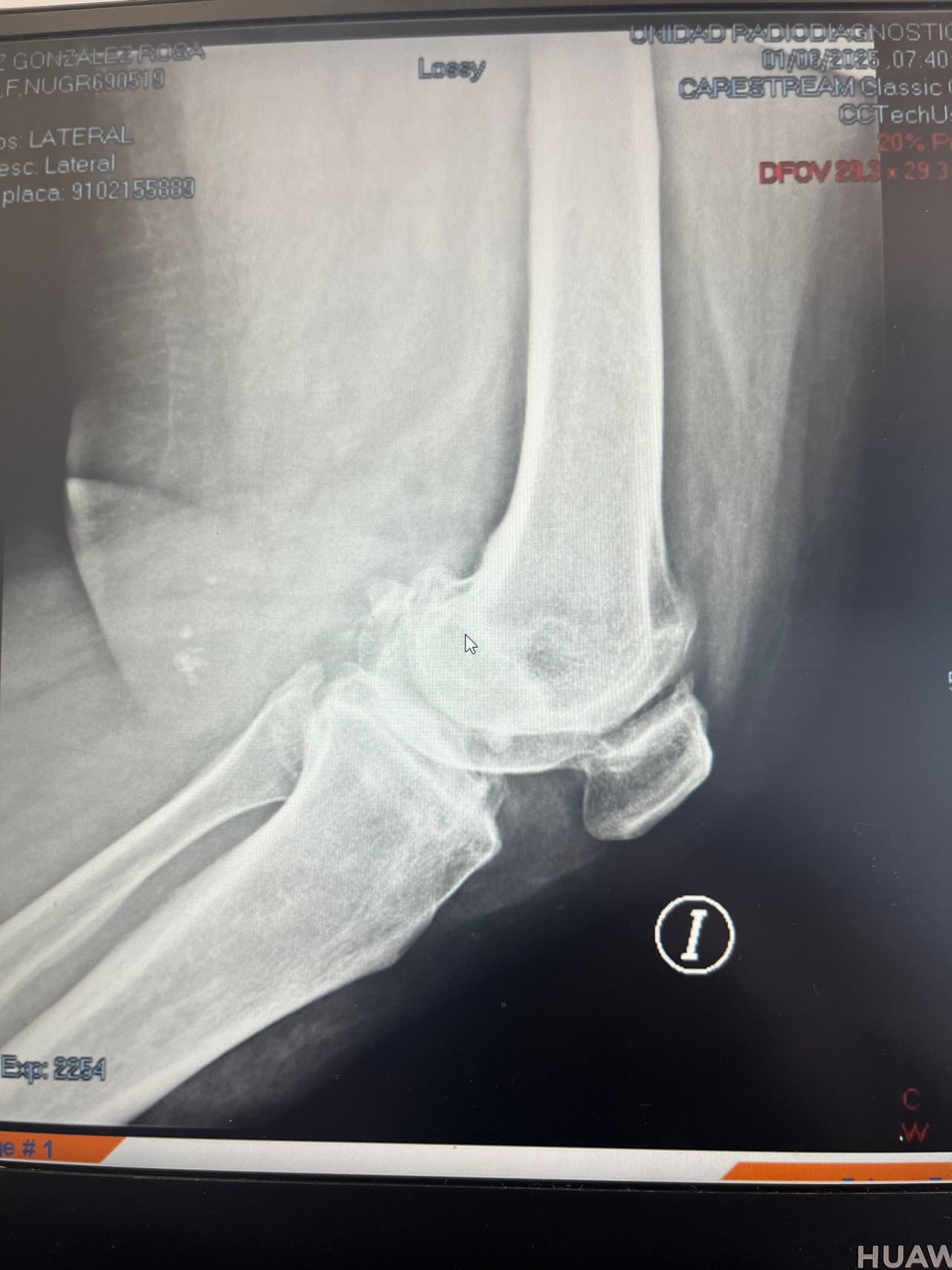 Manuel Alejandro Villagrán Luján-13