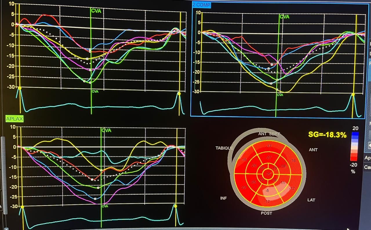 Alba Melina Ascañio Flores-4