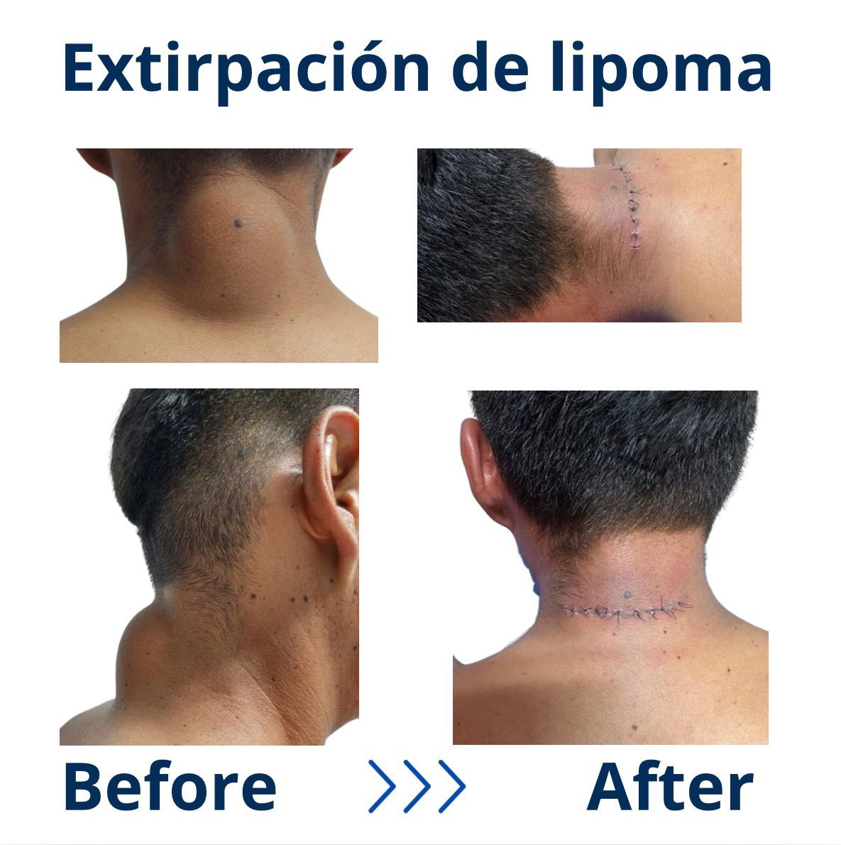 Itzel Anayn Flores Reyes-41