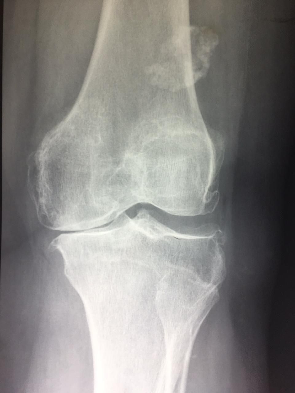 Neftali Lagos Mariscal-2