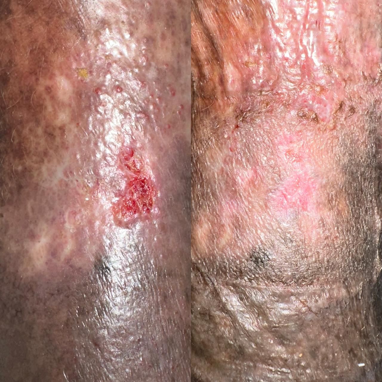 Jhonatan López González-39