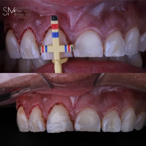 Arturo Mendez Valencia-38