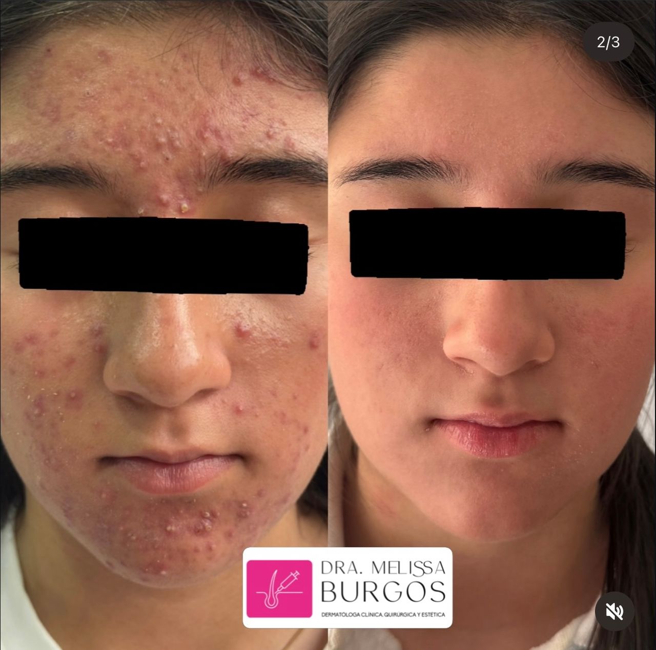 Melissa Burgos Romero-17