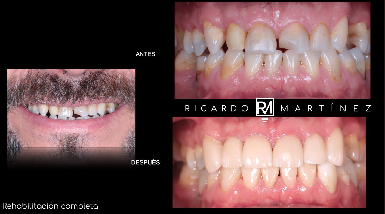 J. Ricardo Martínez-13