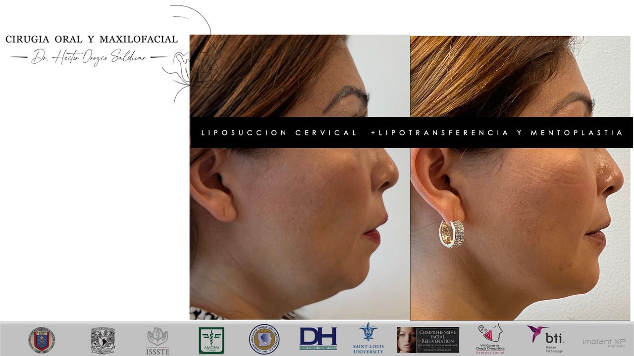 Héctor Adolfo Orozco Saldívar-21